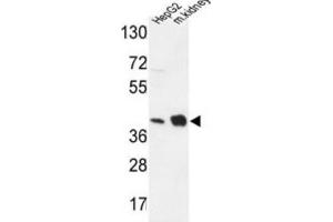 Western Blotting (WB) image for anti-NADH Dehydrogenase (Ubiquinone) 1 alpha Subcomplex, 10, 42kDa (NDUFA10) antibody (ABIN3004309) (NDUFA10 Antikörper)