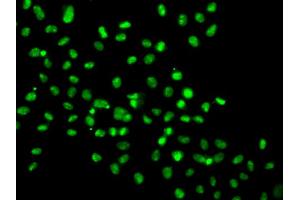 Immunofluorescence analysis of MCF-7 cells using HMG20A antibody (ABIN5974388). (HMG20A Antikörper)