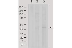 Western blot analysis of extracts from various samples, using WTAP Antibody. (WTAP Antikörper  (C-Term))