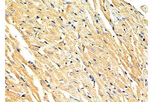 ABIN6263592 and ABIN6279797 at 1/100 staining Rat heart tissue by IHC-P. (NEK4 Antikörper  (Internal Region))