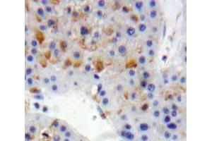 Used in DAB staining on fromalin fixed paraffin-embedded Liver tissue (LDLR Antikörper  (AA 497-742))