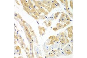 Immunohistochemistry of paraffin-embedded mouse heart using PCBP2 antibody. (PCBP2 Antikörper)