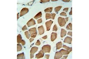 Immunohistochemistry analysis in formalin fixed and paraffin embedded skeletal muscle reacted with PDK2 Antibody  followed by peroxidase conjugation of the secondary antibody and DAB staining. (PDK2 Antikörper)