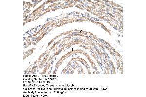 Rabbit Anti-CPSF6 Antibody  Paraffin Embedded Tissue: Human Muscle Cellular Data: Skeletal muscle cells Antibody Concentration: 16. (CPSF6 Antikörper  (Middle Region))
