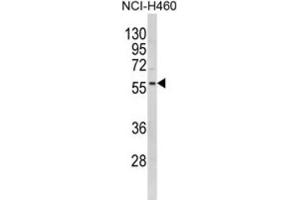 Western Blotting (WB) image for anti-Potassium Inwardly-Rectifying Channel, Subfamily J, Member 2 (KCNJ2) antibody (ABIN3002884)