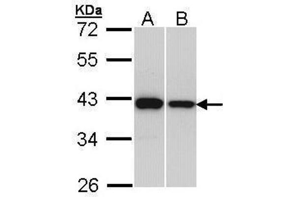 RAD51 Antikörper  (Center)