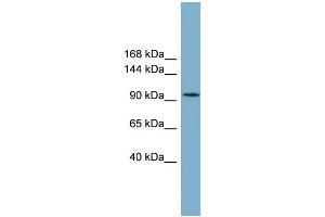 WB Suggested Anti-SLC12A3 Antibody Titration:  0. (SLC12A3 Antikörper  (Middle Region))