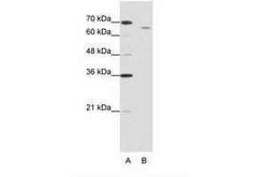 Image no. 2 for anti-Cleavage and Polyadenylation Specific Factor 3, 73kDa (CPSF3) (C-Term) antibody (ABIN202869)