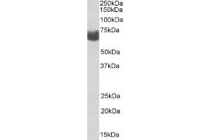 ABIN2613381 (2µg/ml) staining of Human Ovary lysate (35µg protein in RIPA buffer).