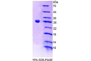 SDS-PAGE analysis of Mouse CNTN2 Protein. (CNTN2 Protein)