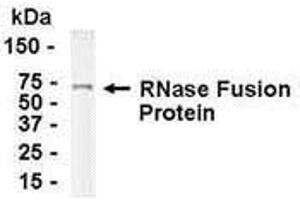 Western Blotting (WB) image for anti-Ribonuclease, RNase A Family, 1 (Pancreatic) (RNASE1) (AA 1-156) antibody (ABIN2468182) (RNASE1 Antikörper  (AA 1-156))