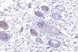 Immunohistochemistry (Paraffin-embedded Sections) (IHC (p)) image for anti-Nucleoporin 133kDa (NUP133) antibody (ABIN7074909)