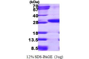 Ethylmalonic Encephalopathy 1 (ETHE1) (AA 13-254) protein (His tag)