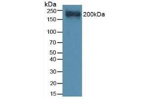 Detection of VCAN in Mouse Heart Tissue using Polyclonal Antibody to Versican (VCAN) (Versican Antikörper  (AA 3058-3299))