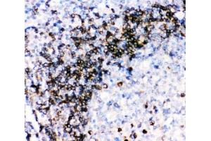 IHC-P: CD79a antibody testing of human tonsil tissue