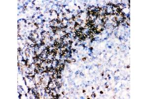 IHC-P: CD79a antibody testing of human tonsil tissue (CD79a Antikörper  (AA 121-226))