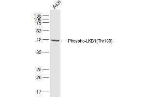 A431 lysates probed with LKB1(Thr189) Polyclonal Antibody, Unconjugated  at 1:500 dilution and 4˚C overnight incubation. (LKB1 Antikörper  (pThr189))