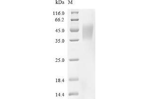 Fc Fragment of IgE Receptor Ia (FCER1A) (AA 26-205) protein (His tag)