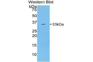 Western blot analysis of recombinant Human ROR1. (ROR1 Antikörper  (AA 540-795))