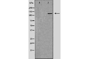 Western Blotting (WB) image for anti-Replication Factor C (Activator 1) 1, 145kDa (RFC1) (Internal Region) antibody (ABIN6264709)
