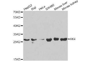 Western blot analysis of extracts of various cell lines, using AK4 antibody (ABIN5971082) at 1/1000 dilution. (AK4 Antikörper)