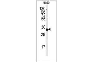 Image no. 1 for anti-Exosome Component 8 (EXOSC8) (C-Term) antibody (ABIN357948) (EXOSC8 Antikörper  (C-Term))