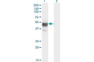 Western Blot analysis of MAGEB1 expression in transfected 293T cell line by MAGEB1 monoclonal antibody (M09), clone 3C1. (MAGEB1 Antikörper  (AA 86-195))