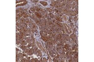 Immunohistochemical staining of human pancreas with ZNF646 polyclonal antibody  shows strong cytoplasmic and membranous positivity in exocrine glandular cells at 1:500-1:1000 dilution. (ZNF646 Antikörper)