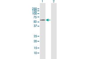 Western Blotting (WB) image for anti-Matrix Metallopeptidase 3 (Stromelysin 1, Progelatinase) (MMP3) (AA 1-477) antibody (ABIN948136)