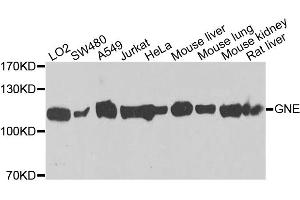 Western blot analysis of extracts of various cell lines, using GNE antibody. (GNE Antikörper)