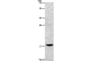 Western blot analysis of Mouse stomach tissue, using GRP Polyclonal Antibody at dilution of 1:1000