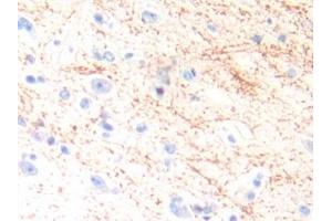 Detection of IL13 in Human Brain Tissue using Polyclonal Antibody to Interleukin 13 (IL13) (IL-13 Antikörper  (AA 25-146))