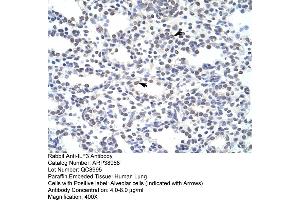 Human Lung (Interleukin enhancer-binding factor 3 (ILF3) (N-Term) Antikörper)