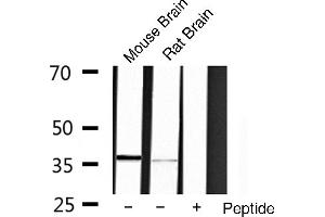 Western blot analysis of extracts of various cell lines,using OCT3 antibody. (OCT4 Antikörper  (Internal Region))
