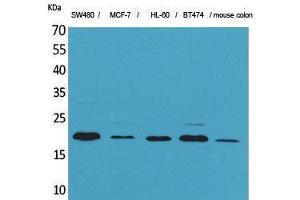 Western Blotting (WB) image for anti-Fibroblast Growth Factor 20 (FGF20) (Internal Region) antibody (ABIN3178209) (FGF20 Antikörper  (Internal Region))