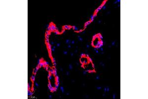 Immunofluorescent analysis of paraffin embedded mouse skin using CK6 (ABIN7074423) at dilution of 1: 2000 (Keratin 6 Antikörper)
