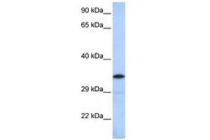 Image no. 1 for anti-BTB (POZ) Domain-Containing Protein KCTD4 (KCTD4) (AA 144-193) antibody (ABIN6742587) (KCTD4 Antikörper  (AA 144-193))