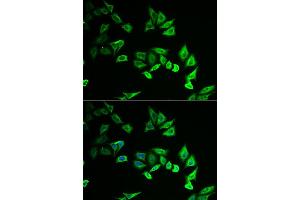 Immunofluorescence analysis of U2OS cell using MYOZ2 antibody. (MYOZ2 Antikörper)