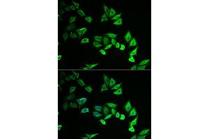 Immunofluorescence analysis of U2OS cell using MYOZ2 antibody. (MYOZ2 Antikörper)