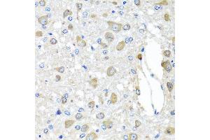 Immunohistochemistry of paraffin-embedded rat brain using BAG5 antibody at dilution of 1:100 (x40 lens). (BAG5 Antikörper)