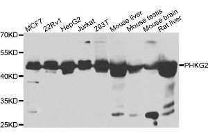 Western blot analysis of extracts of various cell lines, using PHKG2 antibody (ABIN5975111) at 1/1000 dilution. (PHKG2 Antikörper)