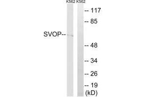 Western blot analysis of extracts from K562 cells, using SVOP antibody. (SVOP Antikörper)
