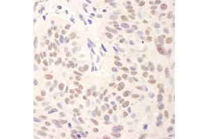 Immunohistochemistry (IHC) image for anti-BMI1 Polycomb Ring Finger Oncogene (BMI1) (AA 276-326) antibody (ABIN7448885)
