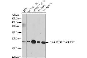 Western blot analysis of extracts of various cell lines, using p16-ARC// Rabbit mAb (ABIN1681279, ABIN3019212, ABIN3019213 and ABIN7101732) at 1:1000 dilution. (ARPC5 Antikörper)