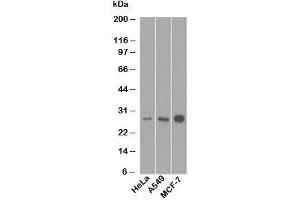 Western blot testing of human samples with Bcl-2 antibody (8C8). (Bcl-2 Antikörper  (AA 41-54))
