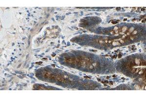 ABIN6274427 at 1/100 staining Mouse intestine tissue by IHC-P. (CAMKV Antikörper  (Internal Region))