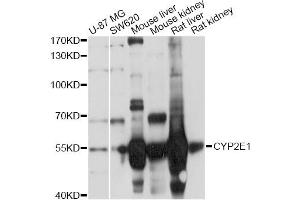 Western blot analysis of extracts of various cell lines, using CYP2E1 Antibody (ABIN5971187) at 1/1000 dilution.