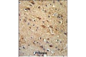 RGR Antibody (Center) (ABIN653851 and ABIN2843113) IHC analysis in formalin fixed and paraffin embedded brain tissue followed by peroxidase conjugation of the secondary antibody and DAB staining.