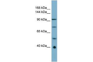 Host:  Rabbit  Target Name:  RBBP6  Sample Type:  ACHN Whole cell lysates  Antibody Dilution:  1. (RBBP6 Antikörper  (N-Term))