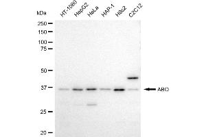 anti-Histo-blood group A transferase (ABO) antibody